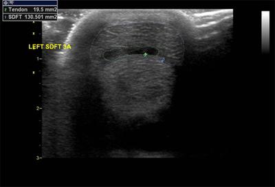 Eccentric lesion in the superficial digital flexor tendon (SDFT)