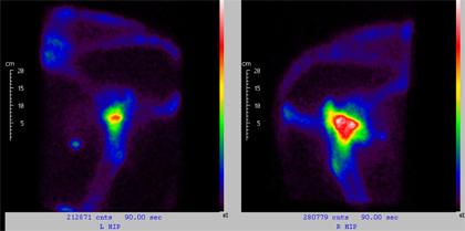 Equine Scintigraphy