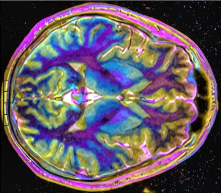 An image of the brain