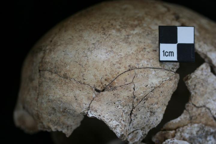 Neolithic cranium with peri-mortem fracture