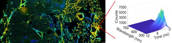 Fluorescence lifetime image human lung tissue with a plot of data contained within each pixel.