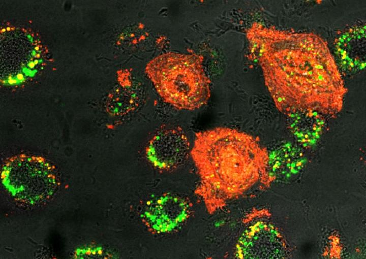 Microscopy image of infected airway epithelial cells treated with LL-37