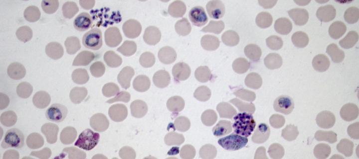 Blood film with malaria parasites