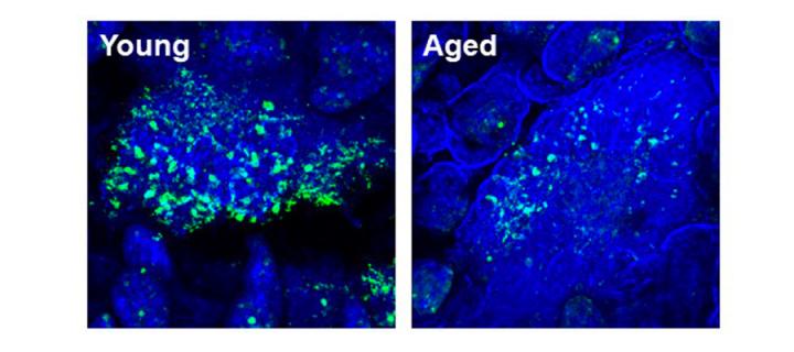 M cells in intestines of young and aged mice