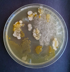 Image of a petri dish covered in microbial growth