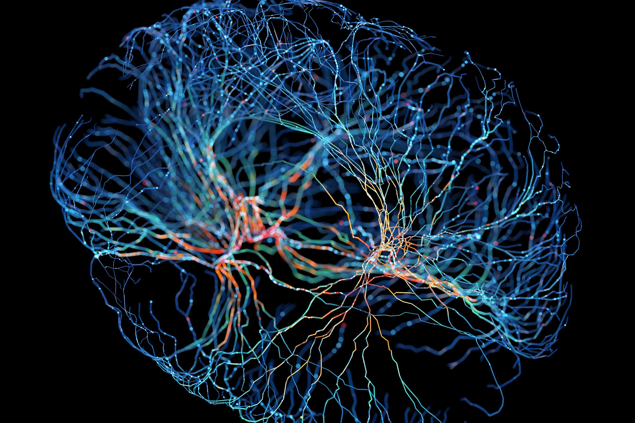 Photo: ed.ac.uk Aging Brains: Faulty Myelin Cells Drive Cognitive Decline