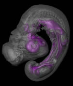 The expression of a protein needed to ensure the healthy formation of digits and other bones of the limbs.