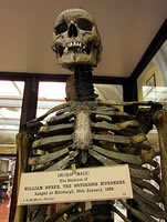 Skeleton of William Burke