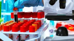 Close up of scientist handling blood samples in tubes next to a microscope