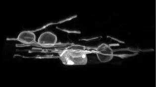 Microscopic image of myelin coating exhibiting swelling