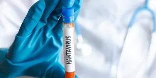 A health worker in a laboratory checks a hantavirus sample in a test tube