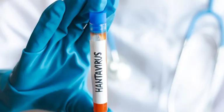 A health worker in a laboratory checks a hantavirus sample in a test tube