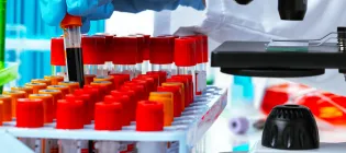 Close up of scientist handling blood samples in tubes next to a microscope