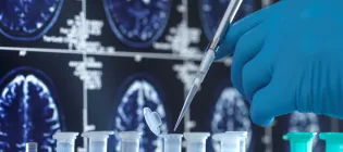 Close up photo of scientist pipetting into small tubes with brain scans in background