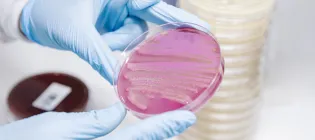Scientist holding a petri dish with bacteria growing on it