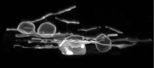 Microscopic image of myelin coating exhibiting swelling