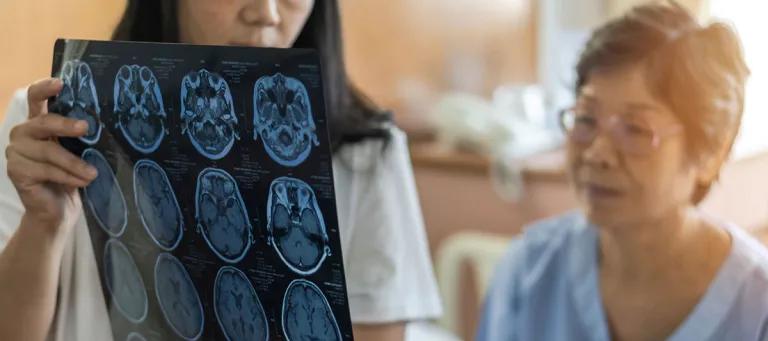 Brain disease diagnosis with medical doctor diagnosing elderly ageing patient neurodegenerative illness problem seeing Magnetic Resonance Imaging (MRI) film for neurological medical treatment