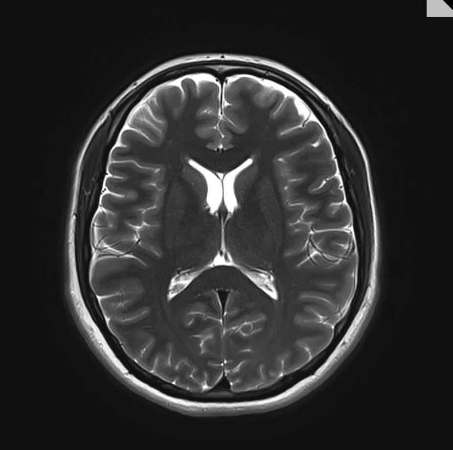 Image of a brain scan
