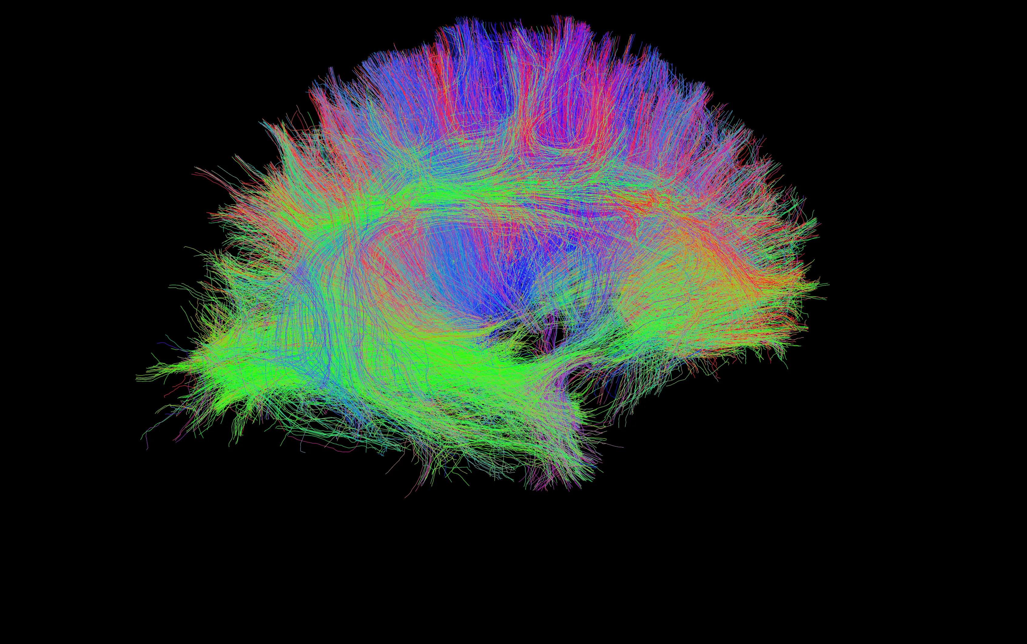 Image of brain scan