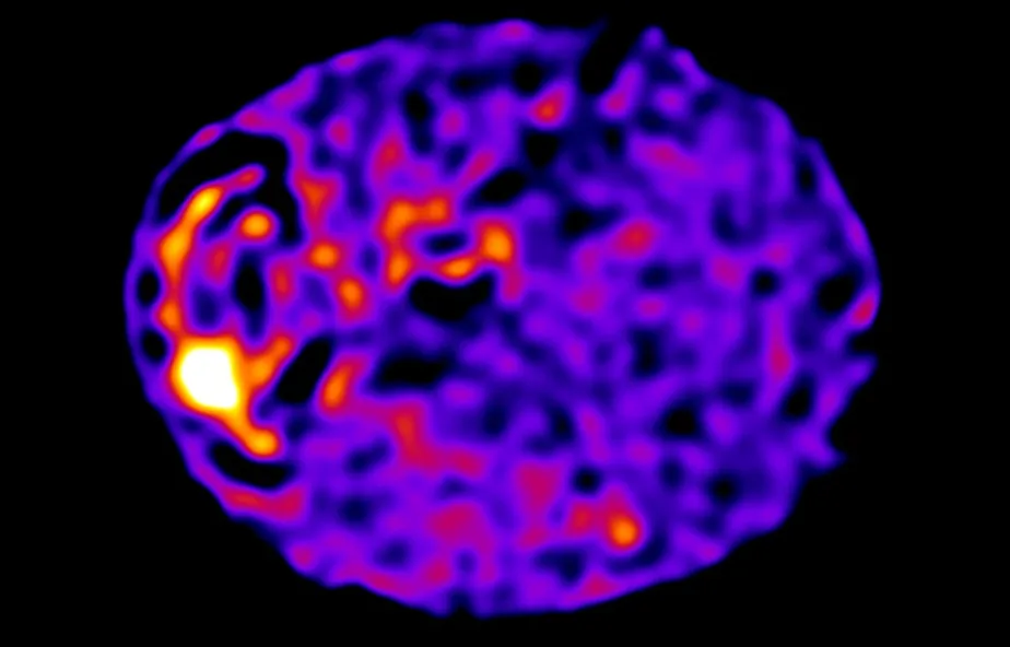 Microscope image of the cell-wide web