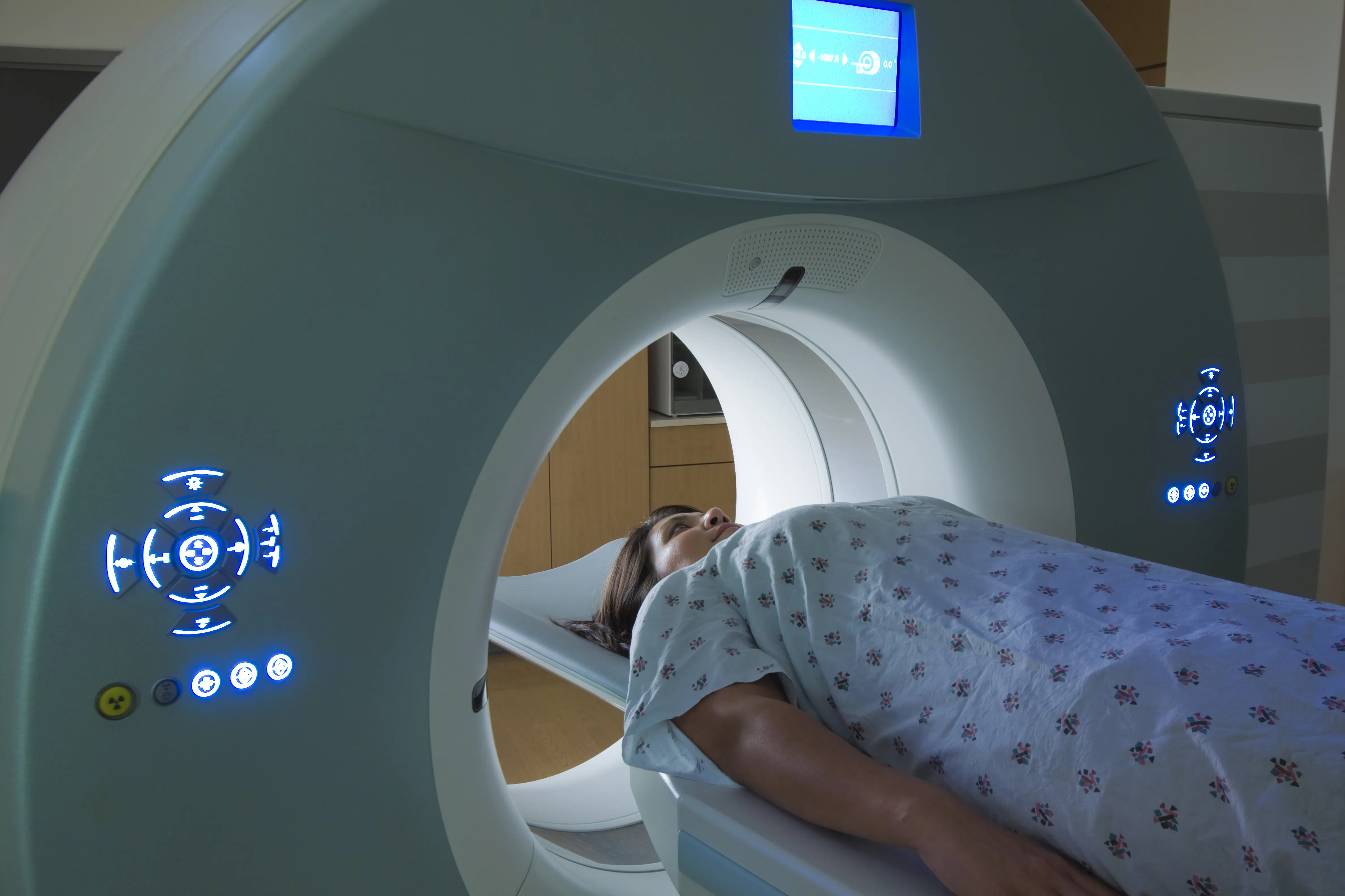 Breast cancer radiotherapy