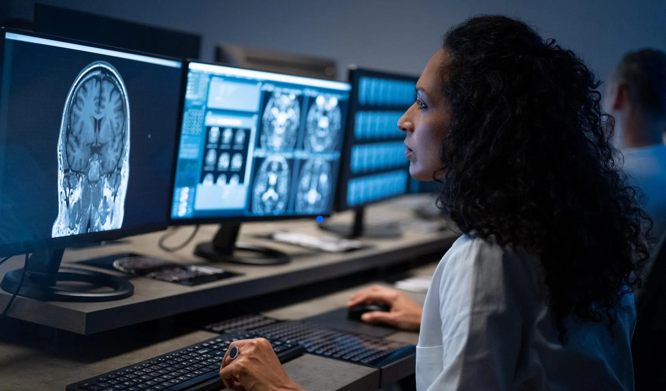 Side view of female radiologist looking at an MRI image of the brain on her computer