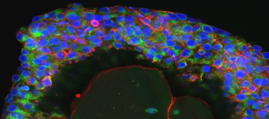Close-up of human egg after development in the lab