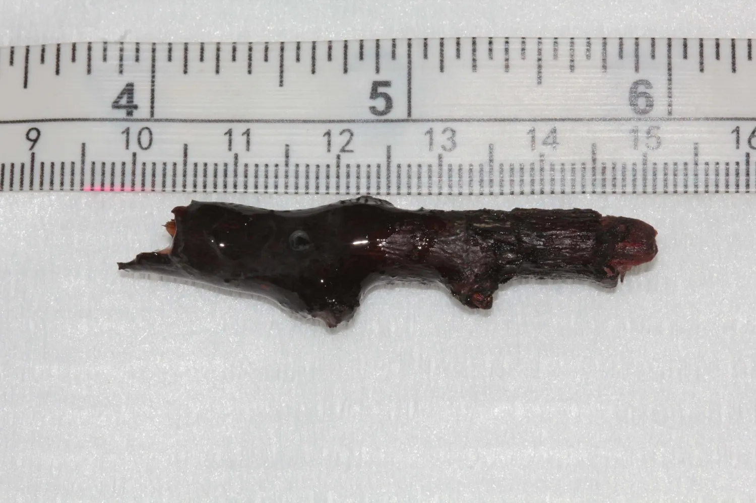 Stick removed from Mia's eye