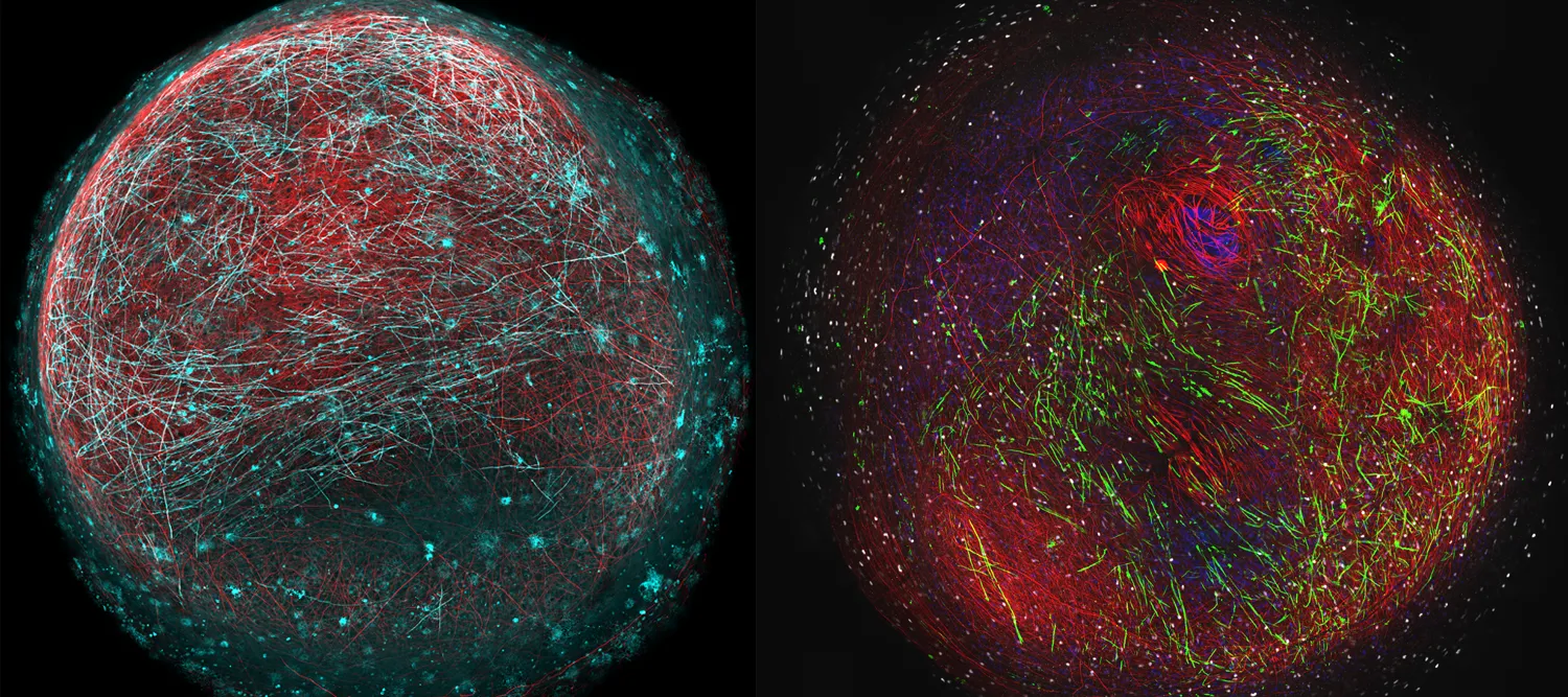 Mini 3-D brain models to speed MS research
