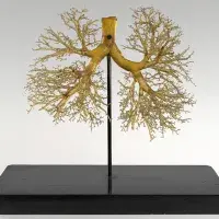 Google/Collection Lung resin cast model 