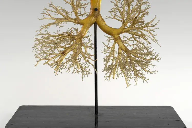 Google/Collection Lung resin cast model 