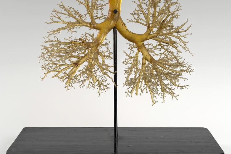 Google/Collection Lung resin cast model 