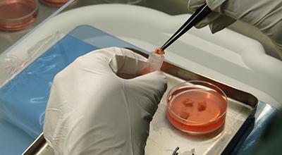 Photo of a scientist preparing ovarian tissue for testing