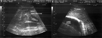 Ultrasound images of abdomen 