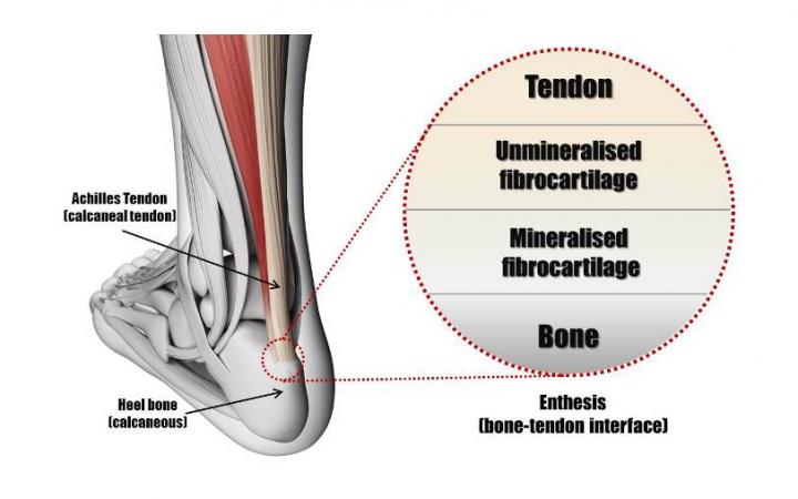 Figure 1 tendon