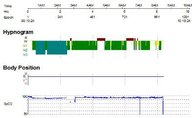 Full sleep report