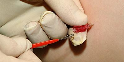 Image of patient being injected with needle
