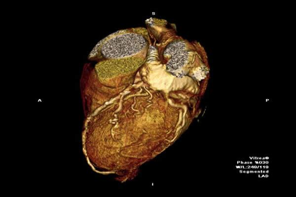The world’s most advanced computerised tomography (CT) scanner is able to scan entire organs such as the heart or brain in less than a second. 