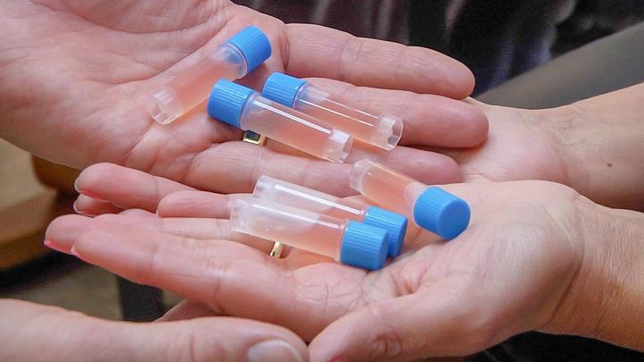Mesenchymal Stem Cell vials in hands