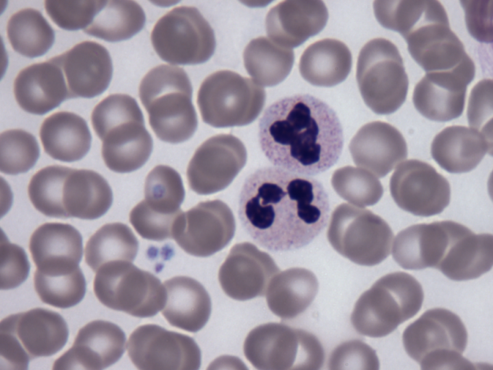 Blood smear showing red and white blood cells - Image Credit: Andrejs Ivanovs