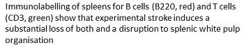 Description of B and T cells