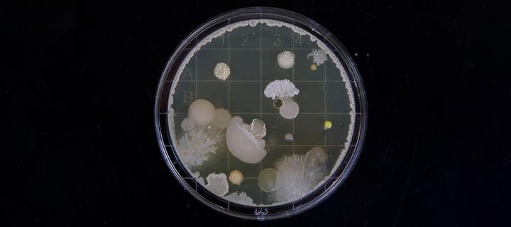 Bacteria Culture