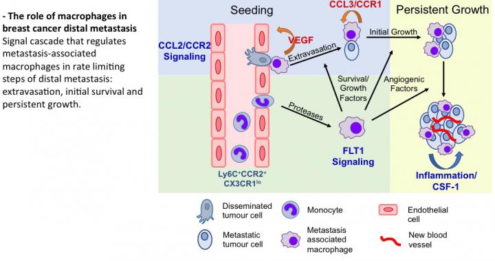 The role of macrophages in breat cancer distal metastasis