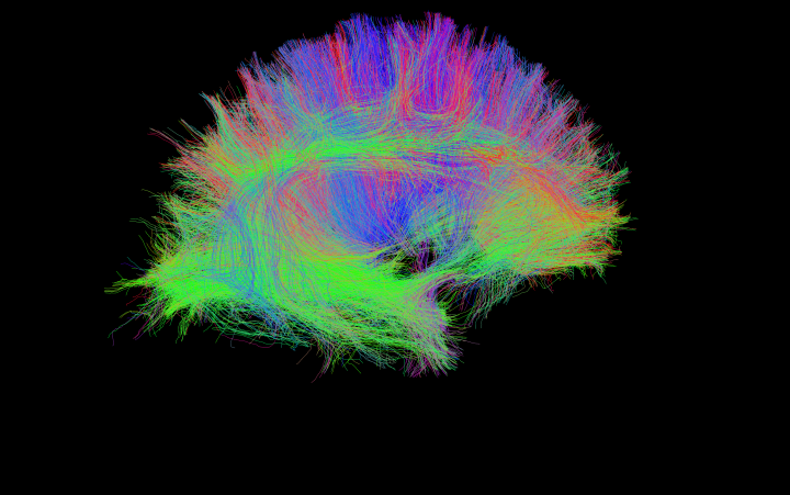 Image of brain scan