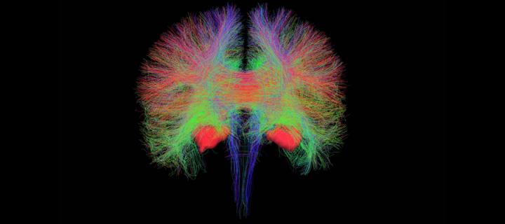 A brain scan: the first image captured by the new MRI scanner at the Royal Infirmary of Edinburgh