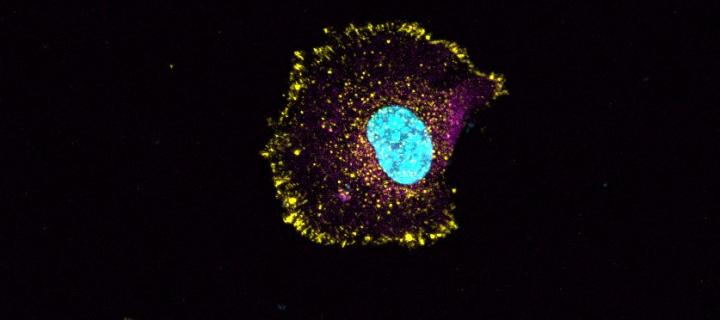 Mammalian cell with nucleus stained in blue and cell adhesion sites in yellow. Image credit: A. Byron.