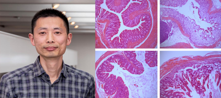Researcher Chengcan Yao next to some sections of gut tissue in pink and purple