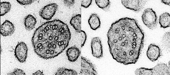 Transmission electron microscopy of TUBB4B mutant motile cilia axonemes in cross-section comparing healthy vs. disrupted microtubule organization. The healthy axonemes are well organised and of similar scale. The mutant axonemes are poorly formed and more disordered.)