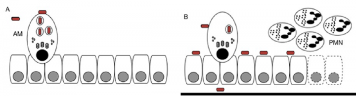 Image of macrophages overwhelmed by bacteria leading to inflammatory response and risk of inflammatory injury to exposed tissue