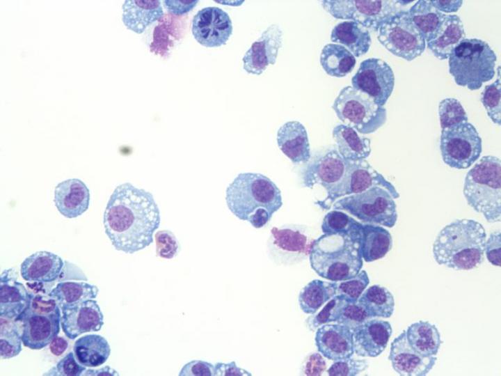 Image of a cytospin showing peritoneal macrophages undergoing mitosis following injection of IL-4